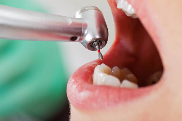 Best Emergency Dental Surgery in Paisley, FL